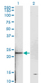 TNNI2 Antibody - Western Blot analysis of TNNI2 expression in transfected 293T cell line by TNNI2 monoclonal antibody (M05), clone 2D5.Lane 1: TNNI2 transfected lysate(21.3 KDa).Lane 2: Non-transfected lysate.
