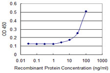 TNNI2 Antibody - Detection limit for recombinant GST tagged TNNI2 is 3 ng/ml as a capture antibody.