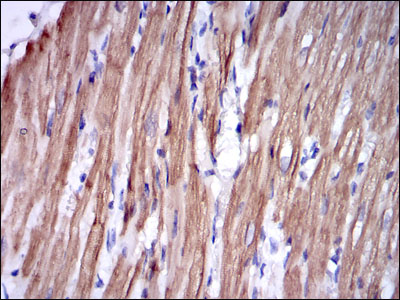 TNNI2 Antibody - IHC of paraffin-embedded rabbit cardiac muscle tissues using TNNI2 mouse monoclonal antibody with DAB staining.
