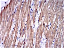 TNNI2 Antibody - IHC of paraffin-embedded rabbit cardiac muscle tissues using TNNI2 mouse monoclonal antibody with DAB staining.
