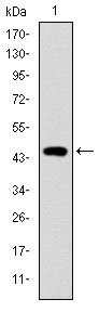 TNNI2 Antibody - Western blot using TNNI2 monoclonal antibody against human TNNI2 (AA: 1-182) recombinant protein.(Expected MW is 46.8 kDa)