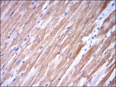 TNNI2 Antibody - IHC of paraffin-embedded cardiac muscle tissues using TNNI2 mouse monoclonal antibody with DAB staining.