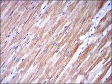 TNNI2 Antibody - IHC of paraffin-embedded cardiac muscle tissues using TNNI2 mouse monoclonal antibody with DAB staining.