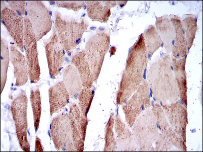 TNNI2 Antibody - IHC of paraffin-embedded striated muscle tissues using TNNI2 mouse monoclonal antibody with DAB staining.