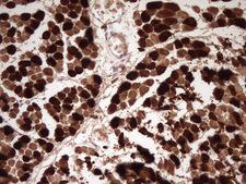 TNNI2 Antibody - Immunohistochemical staining of paraffin-embedded Human muscle tissue using anti-TNNI2 mouse monoclonal antibody. (Heat-induced epitope retrieval by 1 mM EDTA in 10mM Tris, pH8.5, 120C for 3min,