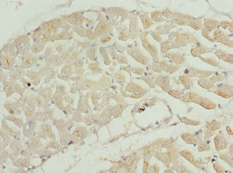 TNNI2 Antibody - Immunohistochemistry of paraffin-embedded human heart tissue at dilution 1:100