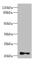 TNNI2 Antibody - Western blot All Lanes: TNNI2 antibody at 3.83ug/ml+ Mouse skeletal muscle tissue Goat polyclonal to rabbit at 1/10000 dilution Predicted band size: 21 kDa Observed band size: 21 kDa