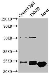 TNNI2 Antibody - Immunoprecipitating TNNI2 in Mouse skeletal muscle tissue Lane 1: Rabbit control IgG instead of TNNI2 Antibody in Mouse skeletal muscle tissue.For western blotting, a HRP-conjugated Protein G antibody was used as the secondary antibody (1/2000) Lane 2: TNNI2 Antibody (8µg) + Mouse skeletal muscle tissue (500µg) Lane 3: Mouse skeletal muscle tissue (10µg)