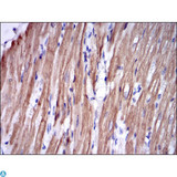 TNNI2 Antibody - Immunohistochemistry (IHC) analysis of paraffin-embedded Rabbit cardiac muscle tissues with DAB staining using Troponin I-FS Monoclonal Antibody.
