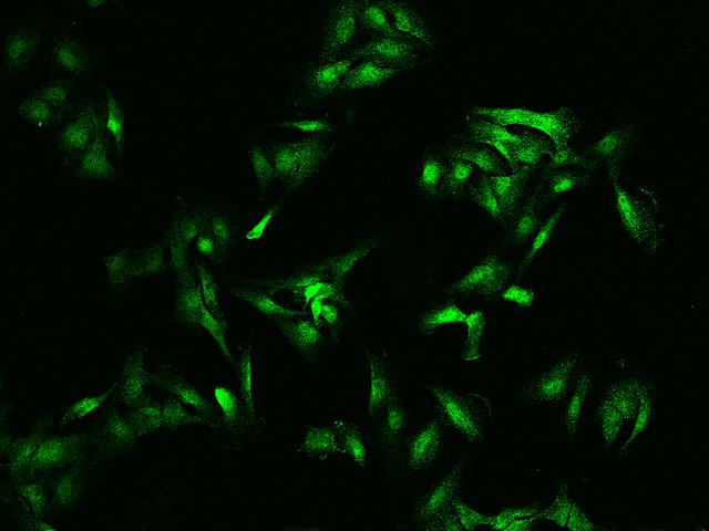 TNNI2 Antibody - Immunofluorescence staining of TNNI2 in U251MG cells. Cells were fixed with 4% PFA, permeabilzed with 0.1% Triton X-100 in PBS, blocked with 10% serum, and incubated with rabbit anti-human TNNI2 polyclonal antibody (dilution ratio 1:1000) at 4°C overnight. Then cells were stained with the Alexa Fluor 488-conjugated Goat Anti-rabbit IgG secondary antibody (green). Positive staining was localized to nucleus and cytoplasm.