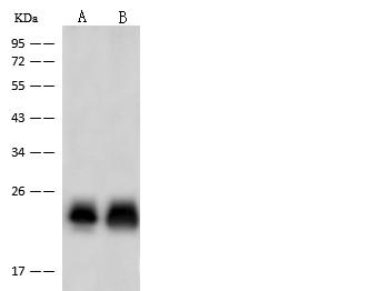 TNNI2 Antibody - Anti-TNNI2 rabbit polyclonal antibody at 1:10000 dilution. Lane A: Mouse skeletal muscle tissue lysate. Lane B: Rat skeletal muscle tissue lysate. Lysates/proteins at 10 ug per lane. Secondary: Goat Anti-Rabbit IgG (H+L)/HRP at 1/10000 dilution. Developed using the ECL technique. Performed under reducing conditions. Predicted band size: 21 kDa.
