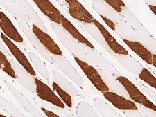 TNNI2 Antibody - Immunochemical staining TNNI2 in human skeletal muscle with rabbit polyclonal antibody at 1:1000 dilution, formalin-fixed paraffin embedded sections.