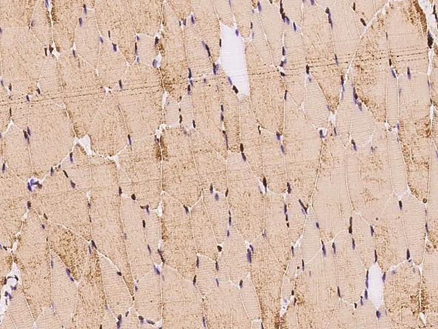 TNNI2 Antibody - Immunochemical staining TNNI2 in rat skeletal muscle with rabbit polyclonal antibody at 1:1000 dilution, formalin-fixed paraffin embedded sections.