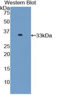 TNNI3 / Cardiac Troponin I Antibody - Western blot of recombinant TNNI3 / CTnI.  This image was taken for the unconjugated form of this product. Other forms have not been tested.