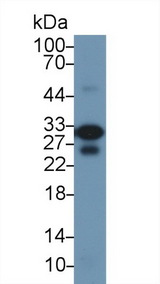 TNNI3 / Cardiac Troponin I Antibody - Western Blot; Sample: Mouse Heart lysate; Primary Ab: 1µg/ml Rabbit Anti-Rat TNNI3 Antibody Second Ab: 0.2µg/mL HRP-Linked Caprine Anti-Rabbit IgG Polyclonal Antibody