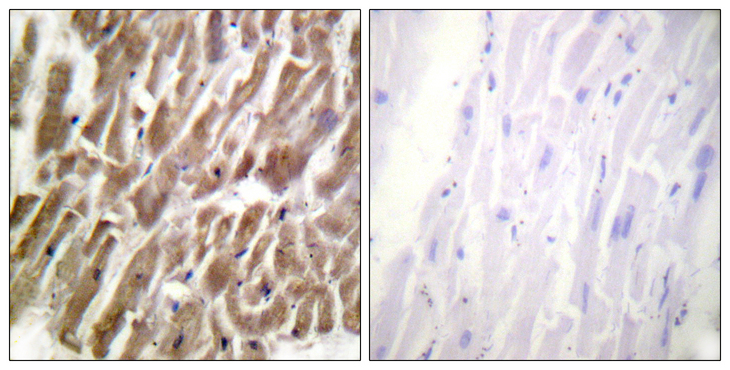 TNNI3 / Cardiac Troponin I Antibody - Immunohistochemistry analysis of paraffin-embedded human heart tissue, using TNNI3 Antibody. The picture on the right is blocked with the synthesized peptide.