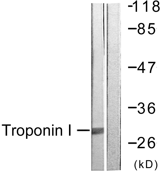 TNNI3 / Cardiac Troponin I Antibody - Western blot analysis of lysates from Jurkat cells, using TNNI3 Antibody. The lane on the right is blocked with the synthesized peptide.