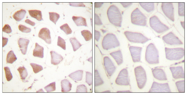 TNNI3 / Cardiac Troponin I Antibody - Immunohistochemistry analysis of paraffin-embedded human skeletal muscle tissue, using TNNI3 Antibody. The picture on the right is blocked with the synthesized peptide.
