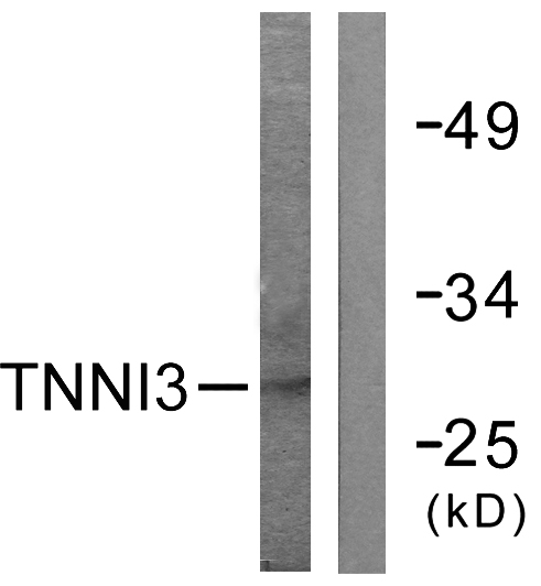 TNNI3 / Cardiac Troponin I Antibody - Western blot analysis of lysates from mouse heart cells, using TNNI3 Antibody. The lane on the right is blocked with the synthesized peptide.