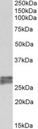 TNNI3 / Cardiac Troponin I Antibody - TNNI3 antibody (0.2 ug/ml) staining of Human Heart lysate (35 ug protein in RIPA buffer). Primary incubation was 1 hour. Detected by chemiluminescence.