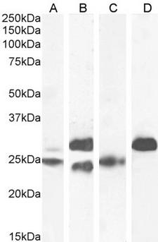 TNNI3 / Cardiac Troponin I Antibody - TNNI3 / Cardiac Troponin I antibody (0.1µg/ml) staining of Human (A), (0.03µg/ml) Mouse (B), (0.1µg/ml) Rat (C) and Pig (D) Heart lysate (35µg protein in RIPA buffer). Detected by chemiluminescence.