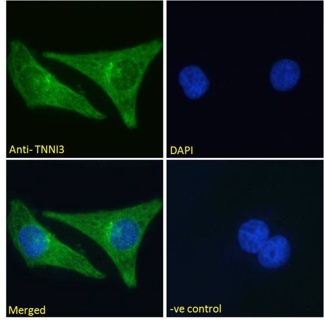TNNI3 / Cardiac Troponin I Antibody - TNNI3 / Cardiac Troponin I antibody immunofluorescence analysis of paraformaldehyde fixed HeLa cells, permeabilized with 0.15% Triton. Primary incubation 1hr (10ug/ml) followed by Alexa Fluor 488 secondary antibody (2ug/ml), showing cytoplasmic staining. The nuclear stain is DAPI (blue). Negative control: Unimmunized goat IgG (10ug/ml) followed by Alexa Fluor 488 secondary antibody (2ug/ml).