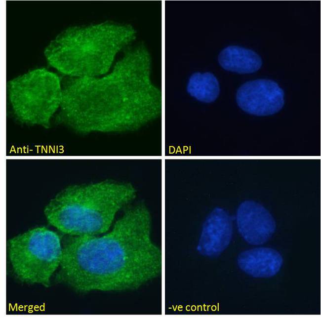 TNNI3 / Cardiac Troponin I Antibody - TNNI3 / Cardiac Troponin I antibody immunofluorescence analysis of paraformaldehyde fixed U2OS cells, permeabilized with 0.15% Triton. Primary incubation 1hr (10ug/ml) followed by Alexa Fluor 488 secondary antibody (2ug/ml), showing vesicle and cytoplasmic staining. The nuclear stain is DAPI (blue). Negative control: Unimmunized goat IgG (10ug/ml) followed by Alexa Fluor 488 secondary antibody (2ug/ml).
