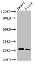 TNNI3 / Cardiac Troponin I Antibody - Western Blot Positive WB detected in:Rat heart tissue,Rat liver tissue All Lanes:Tnni3 antibody at 2.5µg/ml Secondary Goat polyclonal to rabbit IgG at 1/50000 dilution Predicted band size: 25 KDa Observed band size: 25 KDa