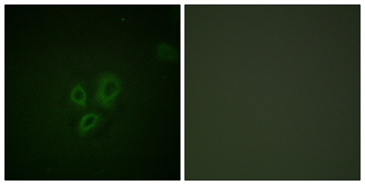 TNNI3 / Cardiac Troponin I Antibody - Immunofluorescence analysis of HepG2 cells, using TNNI3 Antibody. The picture on the right is blocked with the synthesized peptide.