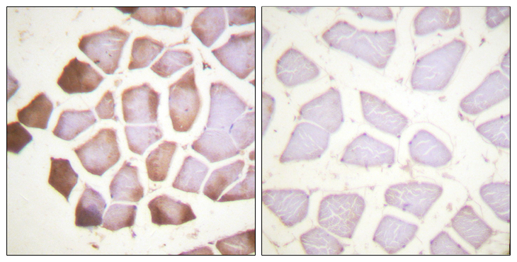 TNNI3 / Cardiac Troponin I Antibody - Immunohistochemistry analysis of paraffin-embedded human skeletal muscle tissue, using TNNI3 Antibody. The picture on the right is blocked with the synthesized peptide.