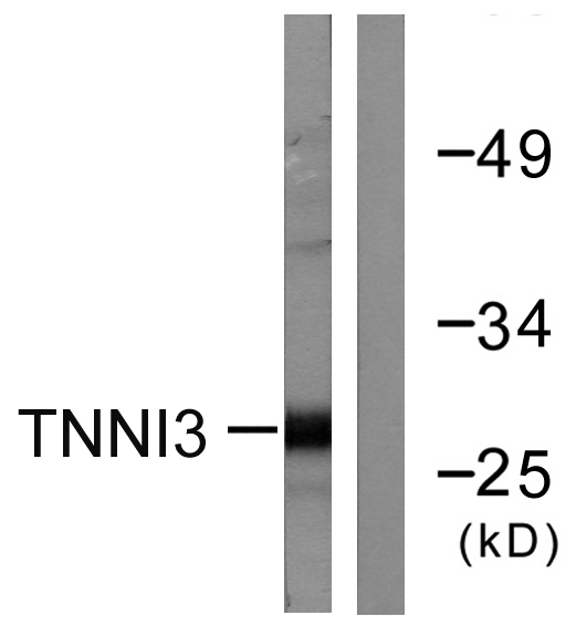 TNNI3 / Cardiac Troponin I Antibody - Western blot analysis of lysates from mouse heart cells, using TNNI3 Antibody. The lane on the right is blocked with the synthesized peptide.