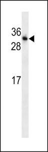 TNNI3 / Cardiac Troponin I Antibody - TNINI3 antibody western blot of HepG2 cell line lysates (35 ug/lane). The TNINI3 antibody detected the TNINI3 protein (arrow).