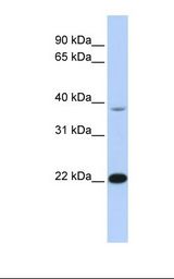 TNNI3 / Cardiac Troponin I Antibody - Fetal muscle lysate. Antibody concentration: 1.0 ug/ml. Gel concentration: 12%.  This image was taken for the unconjugated form of this product. Other forms have not been tested.