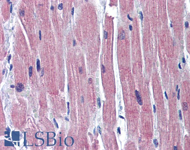 TNNI3 / Cardiac Troponin I Antibody - Anti-TNNI3 / CTnI antibody IHC of human heart. Immunohistochemistry of formalin-fixed, paraffin-embedded tissue after heat-induced antigen retrieval. Antibody concentration 5 ug/ml.  This image was taken for the unconjugated form of this product. Other forms have not been tested.