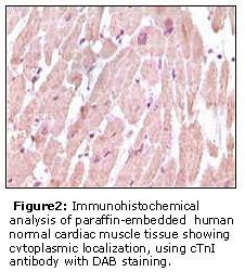 TNNI3 / Cardiac Troponin I Antibody
