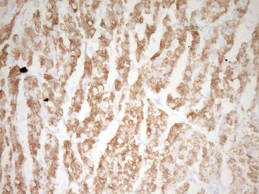 TNNI3 / Cardiac Troponin I Antibody - Immunohistochemical staining of paraffin-embedded Human adult heart tissue using anti-TNNI3 mouse monoclonal antibody. (Heat-induced epitope retrieval by 1 mM EDTA in 10mM Tris, pH8.5, 120C for 3min,