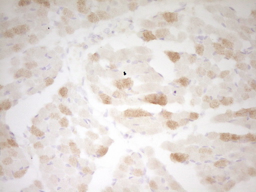 TNNI3 / Cardiac Troponin I Antibody - Immunohistochemical staining of paraffin-embedded Human muscle tissue using anti-TNNI3 mouse monoclonal antibody. (Heat-induced epitope retrieval by 1 mM EDTA in 10mM Tris, pH8.5, 120C for 3min,