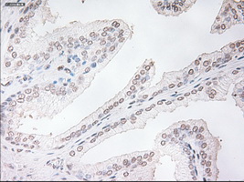 TNNI3 / Cardiac Troponin I Antibody - IHC of paraffin-embedded prostate tissue using anti-TNNI3 mouse monoclonal antibody. (Dilution 1:50).