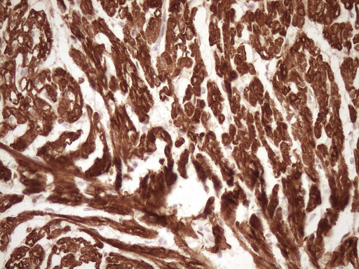 TNNI3 / Cardiac Troponin I Antibody - Immunohistochemical staining of paraffin-embedded Human adult heart tissue using anti-TNNI3 mouse monoclonal antibody. (Heat-induced epitope retrieval by 1 mM EDTA in 10mM Tris, pH8.5, 120C for 3min,