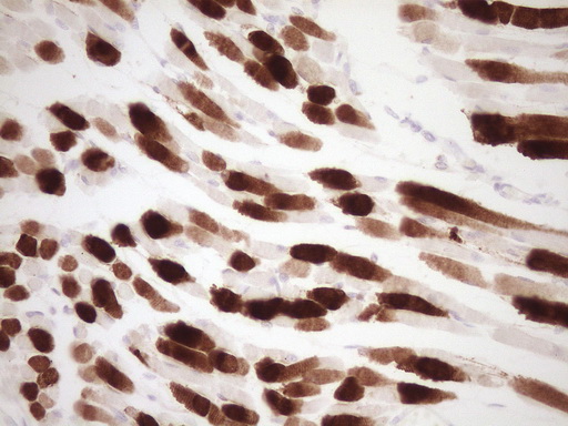 TNNI3 / Cardiac Troponin I Antibody - IHC of paraffin-embedded Human muscle tissue using anti-TNNI3 mouse monoclonal antibody. (Heat-induced epitope retrieval by 1 mM EDTA in 10mM Tris, pH8.5, 120°C for 3min).