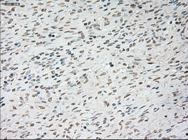 TNNI3 / Cardiac Troponin I Antibody - IHC of paraffin-embedded Ovary tissue using anti-TNNI3 mouse monoclonal antibody. (Dilution 1:50).