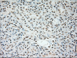 TNNI3 / Cardiac Troponin I Antibody - IHC of paraffin-embedded pancreas tissue using anti-TNNI3 mouse monoclonal antibody. (Dilution 1:50).