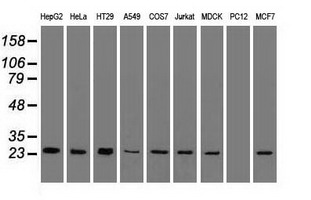 TNNI3 / Cardiac Troponin I Antibody - Western blot of 35 ug of cell extracts from human Liver carcinoma (HepG2) cells using anti-TNNI3 antibody.