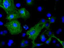 TNNI3 / Cardiac Troponin I Antibody - Western blot of 35 ug of cell extracts from human (HeLa) cells using anti-TNNI3 antibody.