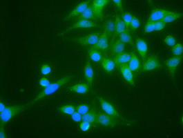 TNNI3 / Cardiac Troponin I Antibody - Western blot of 35 ug of cell extracts from human colon adenocarcinoma (HT29) cells using anti-TNNI3 antibody.