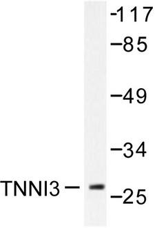 TNNI3 / Cardiac Troponin I Antibody - Western blot of TNNI3 (G136) pAb in extracts from mouse heart.