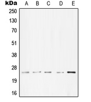 TNNI3 / Cardiac Troponin I Antibody - Western blot analysis of cTnI expression in A431 (A); Molt4 (B); A549 (C); NIH3T3 (D); PC12 (E) whole cell lysates.