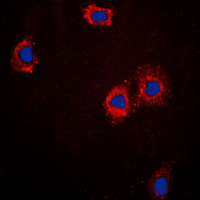 TNNI3 / Cardiac Troponin I Antibody - Immunofluorescent analysis of cTnI staining in A431 cells. Formalin-fixed cells were permeabilized with 0.1% Triton X-100 in TBS for 5-10 minutes and blocked with 3% BSA-PBS for 30 minutes at room temperature. Cells were probed with the primary antibody in 3% BSA-PBS and incubated overnight at 4 C in a humidified chamber. Cells were washed with PBST and incubated with a DyLight 594-conjugated secondary antibody (red) in PBS at room temperature in the dark. DAPI was used to stain the cell nuclei (blue).