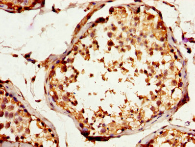 TNNI3 / Cardiac Troponin I Antibody - IHC image of SPA17 Antibody diluted at 1:200 and staining in paraffin-embedded human testis tissue performed on a Leica BondTM system. After dewaxing and hydration, antigen retrieval was mediated by high pressure in a citrate buffer (pH 6.0). Section was blocked with 10% normal goat serum 30min at RT. Then primary antibody (1% BSA) was incubated at 4°C overnight. The primary is detected by a biotinylated secondary antibody and visualized using an HRP conjugated SP system.