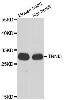 TNNI3 / Cardiac Troponin I Antibody - Western blot analysis of extracts of various cell lines.